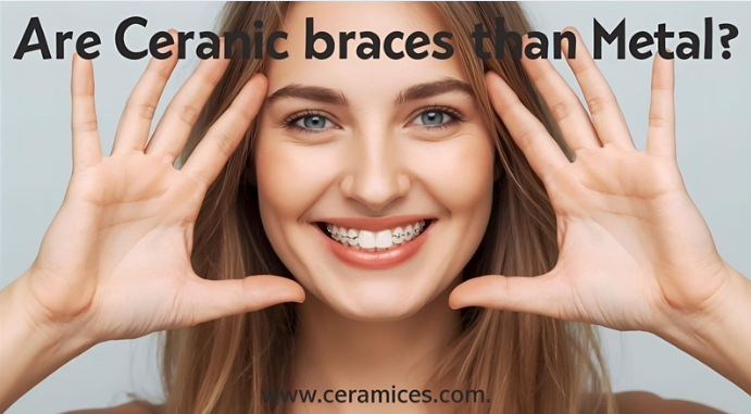 Are Ceramic Braces Better Than Metal?