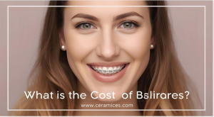 What Is the Cost of Ceramic Braces?